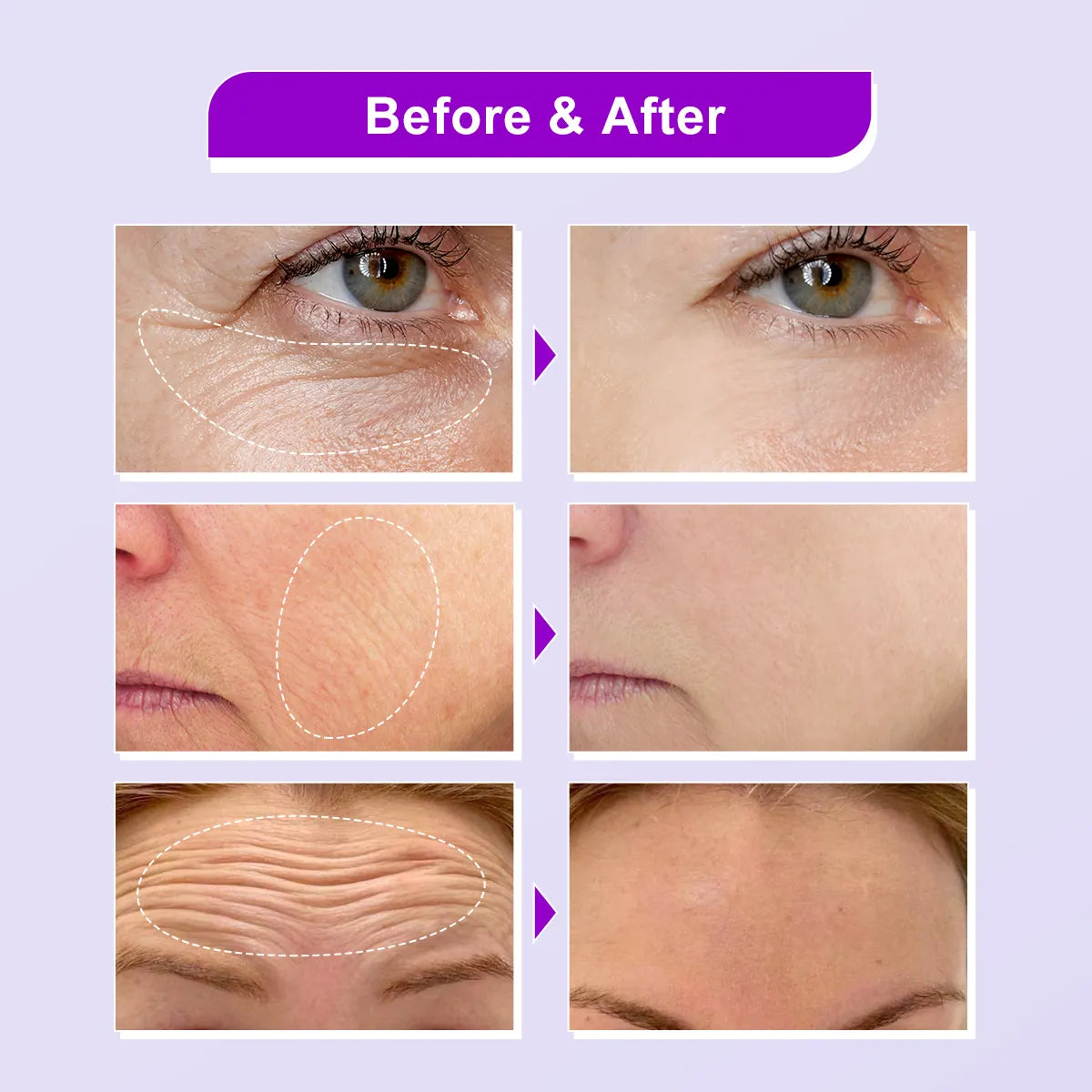 Bakuchiol Facial Serum