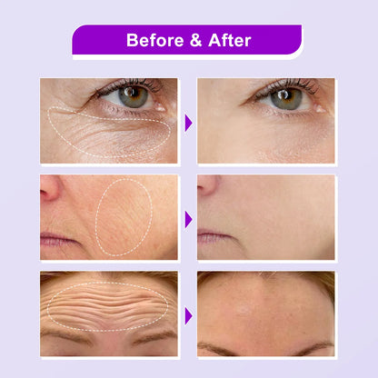 Bakuchiol Facial Serum